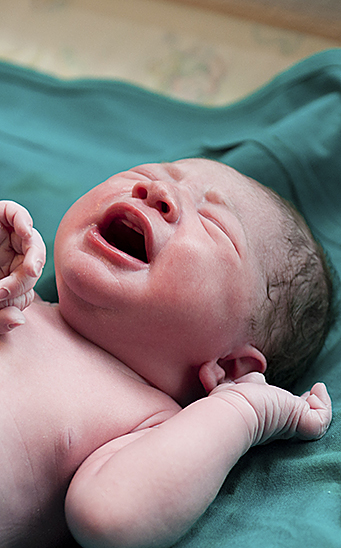 Prueba de Apgar y evaluación del recién nacido