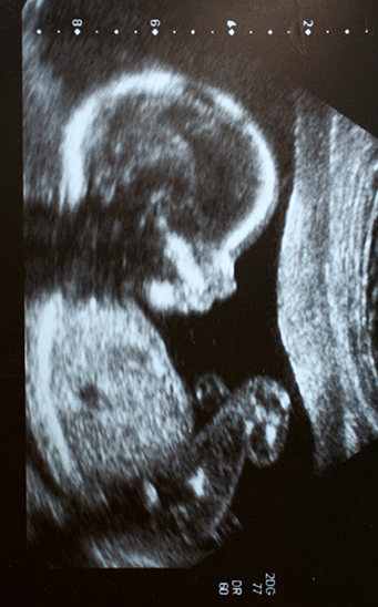 las últimas semanas de gestación las últimas semanas de gestación