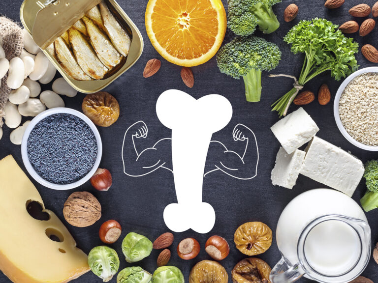 Alimentos para huesos saludables en mesa oscura